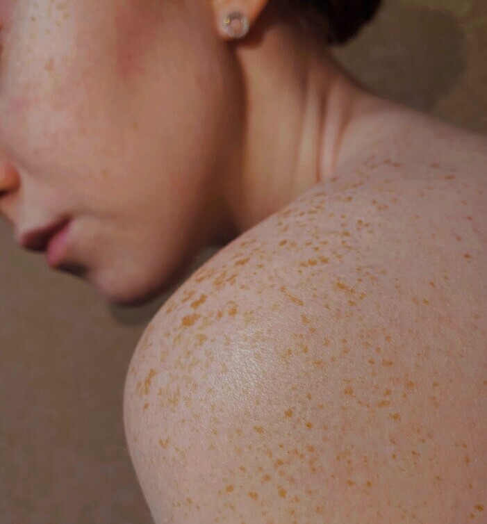 Image of beautiful skin